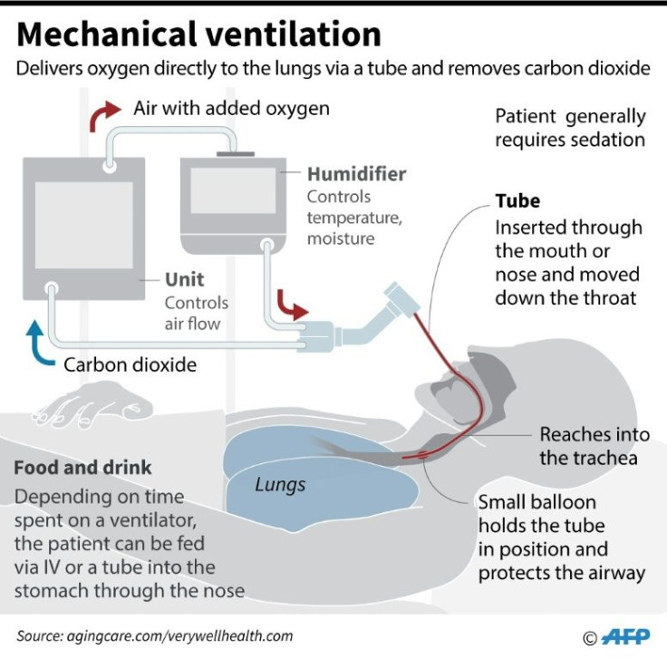 Schematic showing the components of a mechanical ventilator machine, highlighting the placement of a breathing tube in the trachea of a patient.