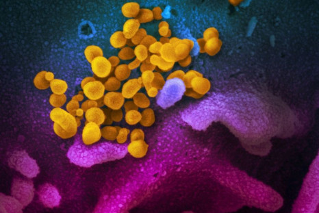 An image taken with a scanning electron microscope  shows SARS-CoV-2 (yellow) â also known as 2019-nCoV, the virus that causes COVID-19