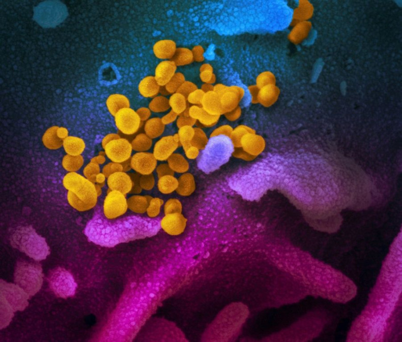 An image taken with a scanning electron microscope shows SARS-CoV-2 (yellow) â also known as 2019-nCoV, the virus that causes COVID-19
