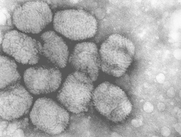 This image from the Center for Disease Control shows a transmission electron micrograph of smallpox viruses