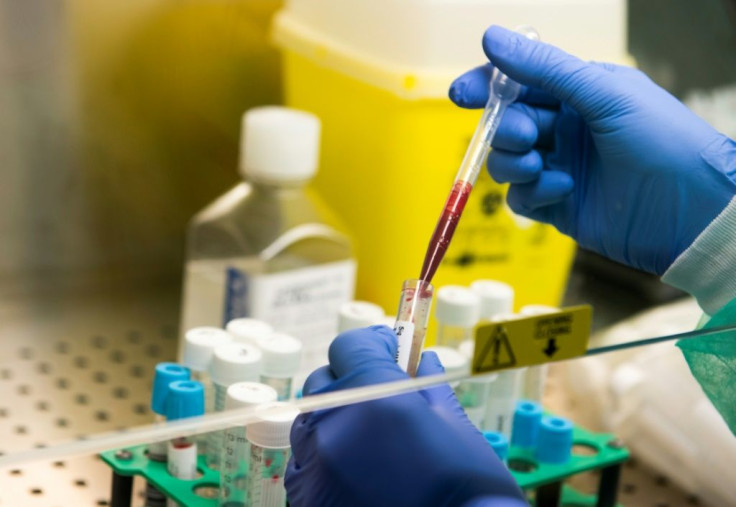 A study found some 98 percent of volunteers had antibodies between 28 and 41 days after the first signs of coronavirus infection