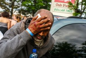 A Somali-American man injured when protesters clashed with police during demonstrations against the death of George Floyd in  Minneapolis on May 27, 2020 -- African refugees have joined the protests against racism