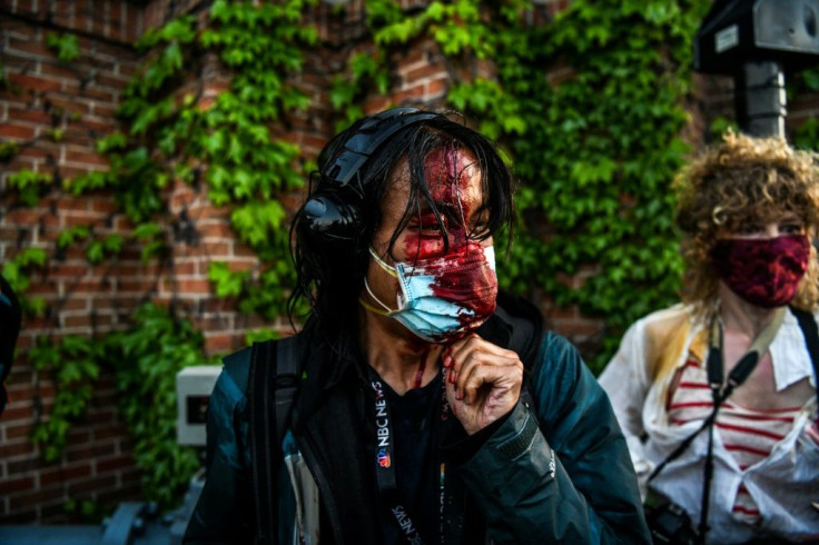 A journalist is seen bleeding after police started firing tear gas and rubber bullets during a demonstration to call for justice for George Floyd, a black man who died while in custody of the Minneapolis police