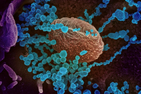 A scanning electron microscope image of SARS-CoV-2 (round blue objects) emerging from the surface of cells cultured in the lab