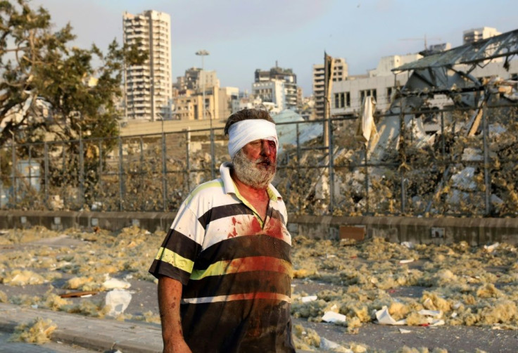 A wounded man walks near the scene of the explosion in Beirut