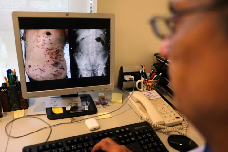 Lebanese doctor Selim Nasser displays the image of a patient's body who was hit by lead pellets fired by security forces during a protest