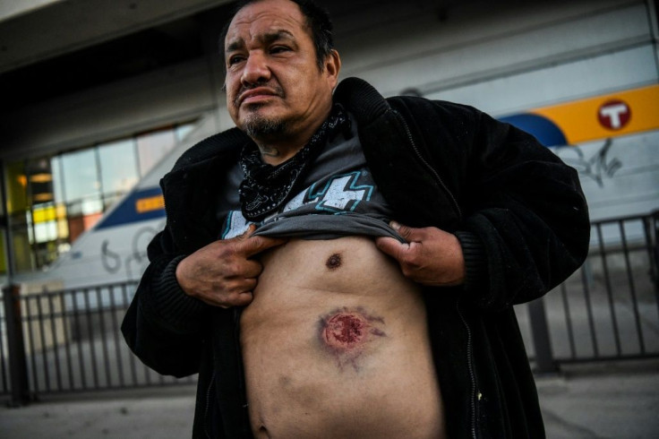 A man shows a wound he said was caused by tear gas shell during a BLM demonstration in Minneapolis on May 29