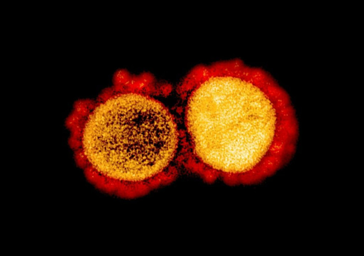 A transmission electron micrograph of SARS-CoV-2 virus particles