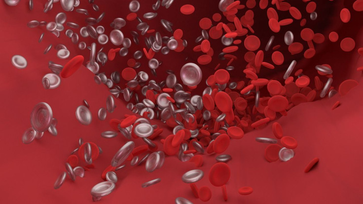 Dangerous blood clotting among COVID-19 patients