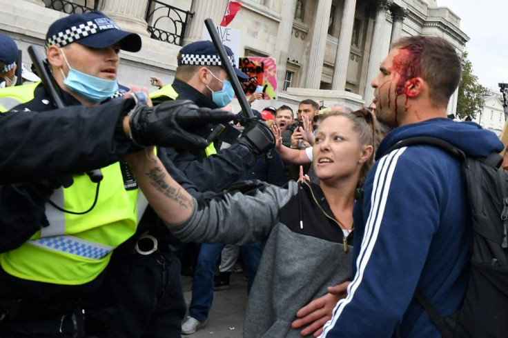 A dozen officers were injured in a similar protest last week