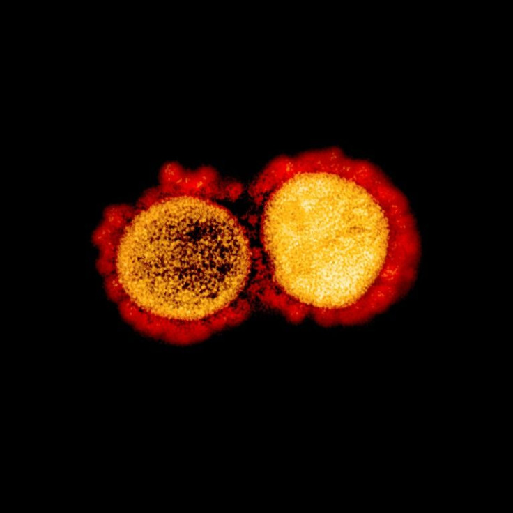 Aa transmission electron micrograph of SARS-CoV-2 virus particles, isolated from a patient,captured and color-enhanced