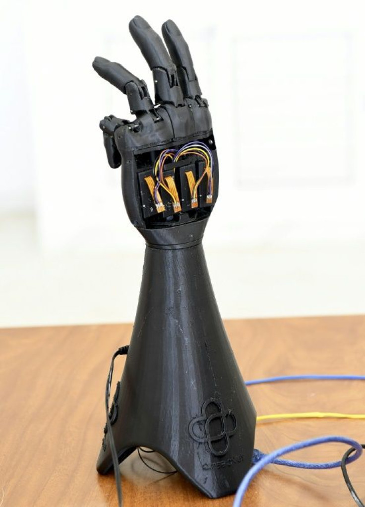 The bionic hand is made of Lego-like parts that can be replaced if damaged or to match a child's physical growth