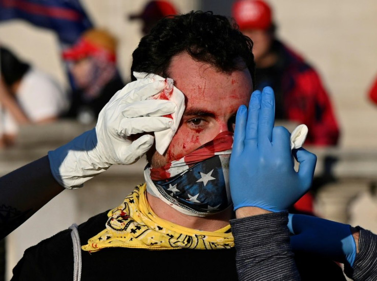 A supporter of US President Donald Trump is helped after being assaulted by an unknown assailant at the rally in Washington