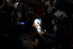 Medics tend to Ameer Alhalbi after he was injured at a Paris rally against a 'global security' draft law, which would criminalise publication of images of on-duty French police officers