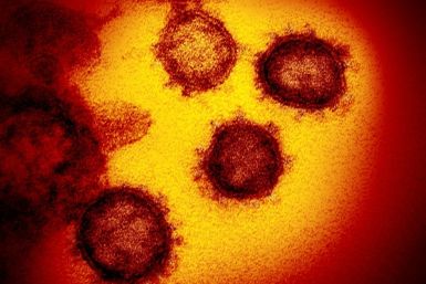 An electron microscopic image  that shows SARS-CoV-2, the virus that causes COVID-19