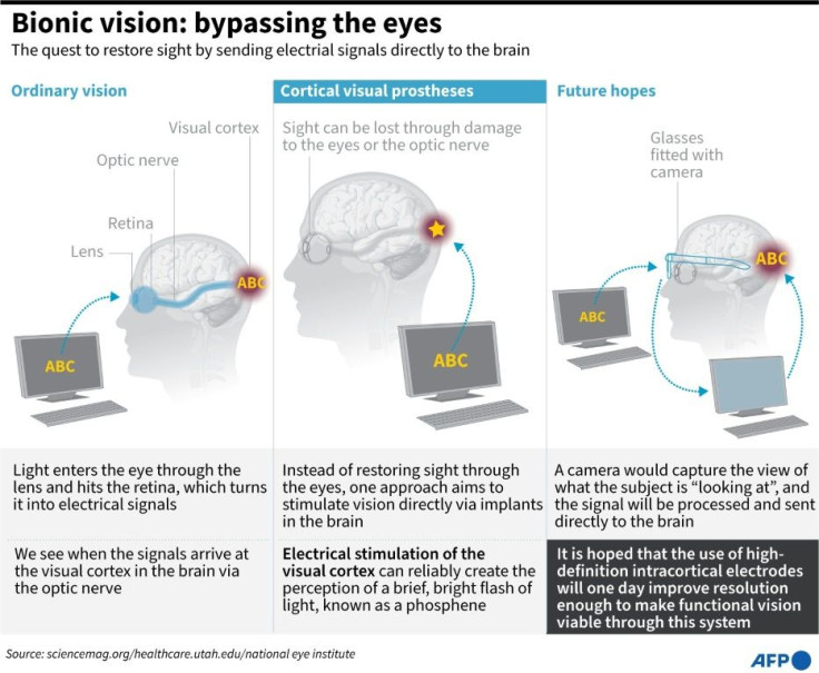 Graphic on how scientists are developing techniques they hope will one day help restore sight to people with damaged eyes, by sending electronic signals directly to the brain