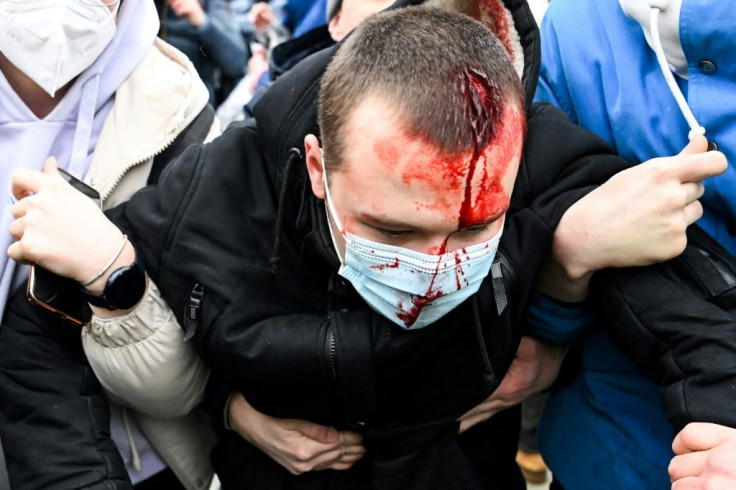 Moscow officials said Sunday that 29 people were taken to hospitals and received medical assistance after the protests