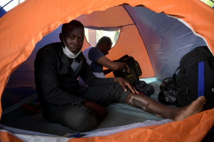 Sudanese migrant Ahmed Kabeer displays the large scar on his leg that forces him to walk with a limp