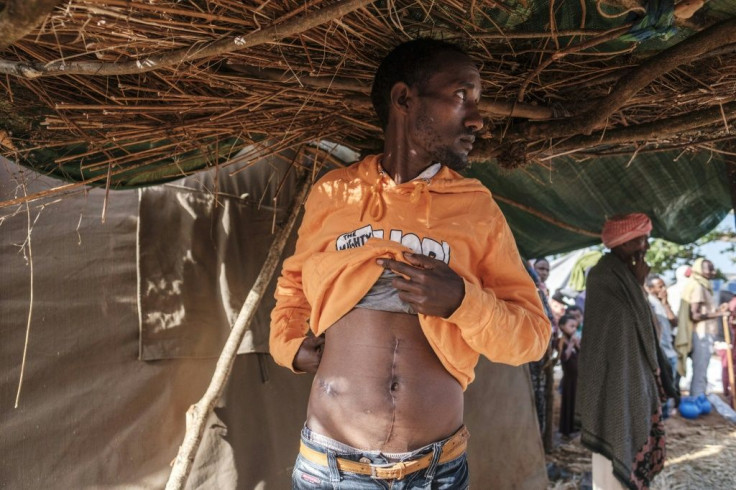 Dawud Kibret shows scars of where he was shot in the abdomen. He is keen to join a government-organized militia