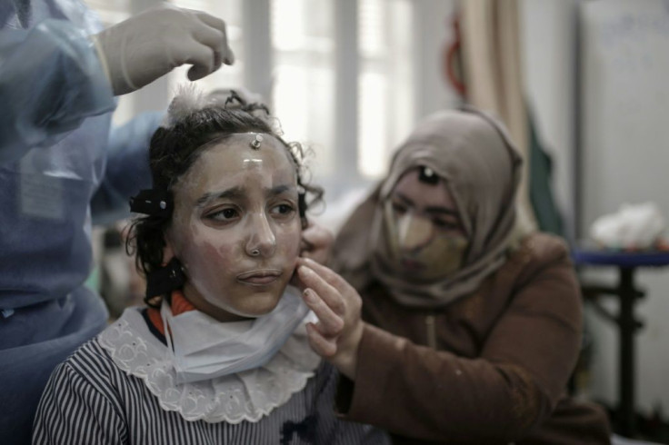 Palestinian schoolgirl Maram al-Amawi has been fitted with a 3D-printed transparent face mask to help heal her severe facial burns