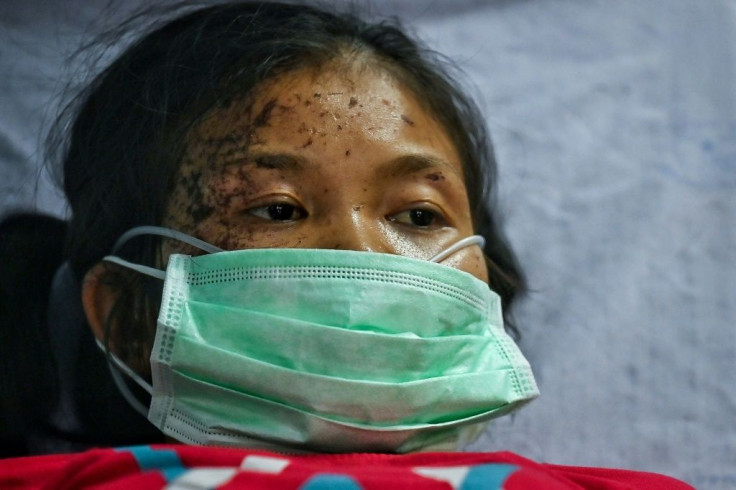 Civilians walked through dense jungle and crossed into neighbouring Thailand for medical treatment following air strikes