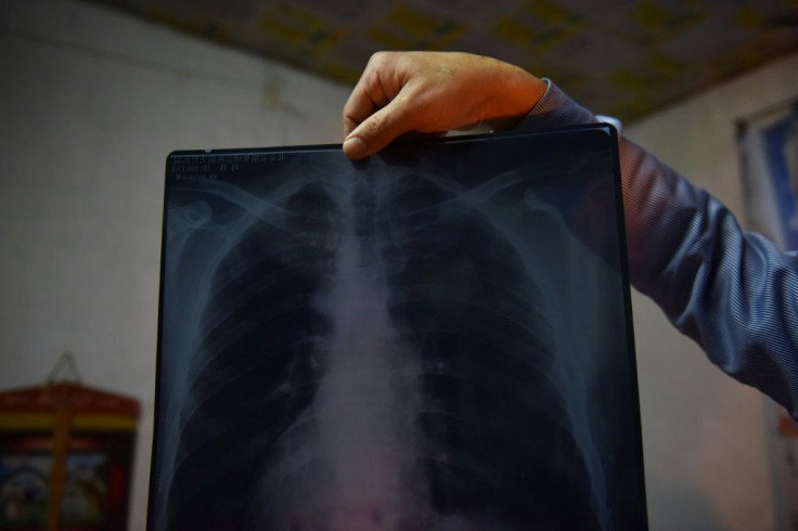 Former coal miner Liu Sheng showing an X-ray of his lungs at his home near the Datai coal mine in Mentougou, west of Beijing, in December 2019