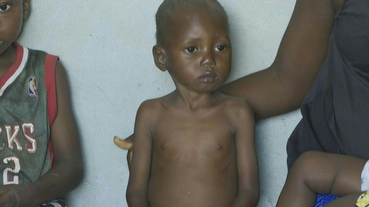 Acute malnutrition stalks the diamond-rich but fragile Kasai region in the Democratic Republic of Congo (DRC) -- the world's worst-hit country in terms of food insecurity, according to the UN. Some 27.3 million people in the DRC are affected by food insec