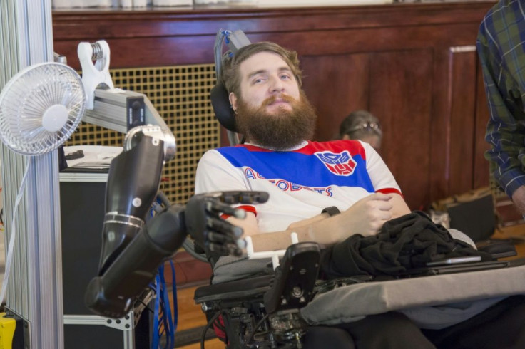 Nathan Copelandcontrols a robotic arm thanks to electrodes implanted in his brain