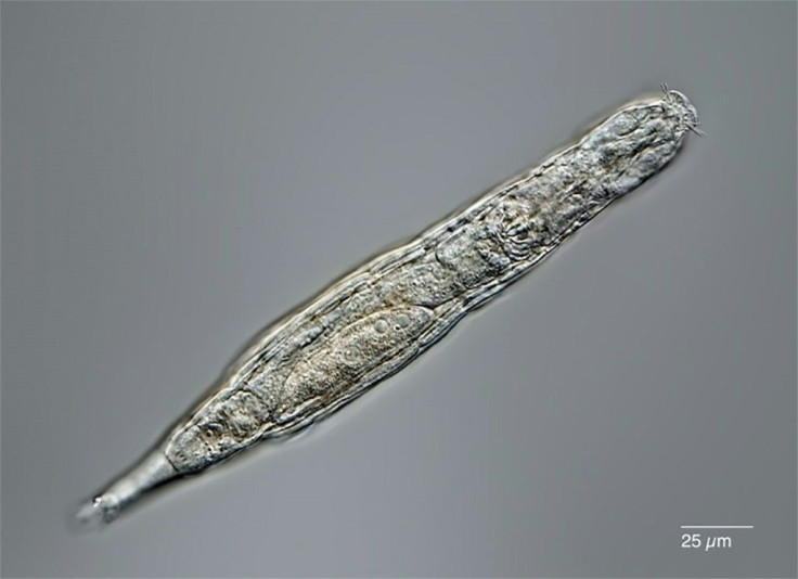 Rotifers can now be added to the list of organisms that can survive seemingly indefinitely