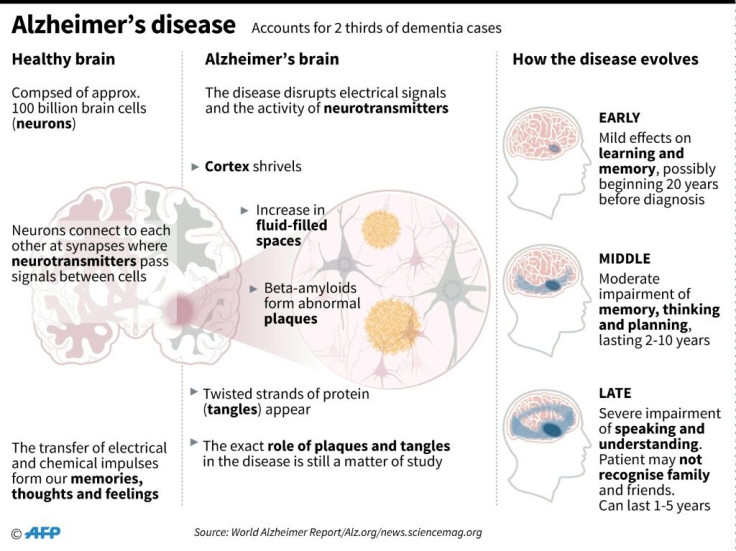 How Alzheimer's disease develops