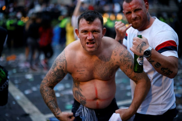 An England fan, injured by a flying bottle, poses for a photograph on the edge of Trafalgar Square during a live screening of the UEFA EURO 2020 final