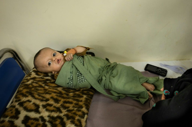 Seven-month-old boy Bilal was born prematurely with a cleft lip and suffered from pneumonia and acute malnutrition when his mother brought him to hospital