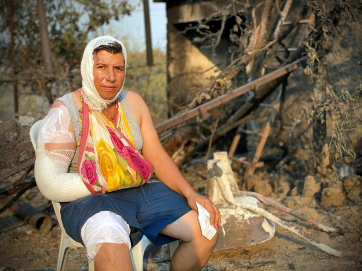More than 330 people have received medical treatment since the fires in Turkey broke out