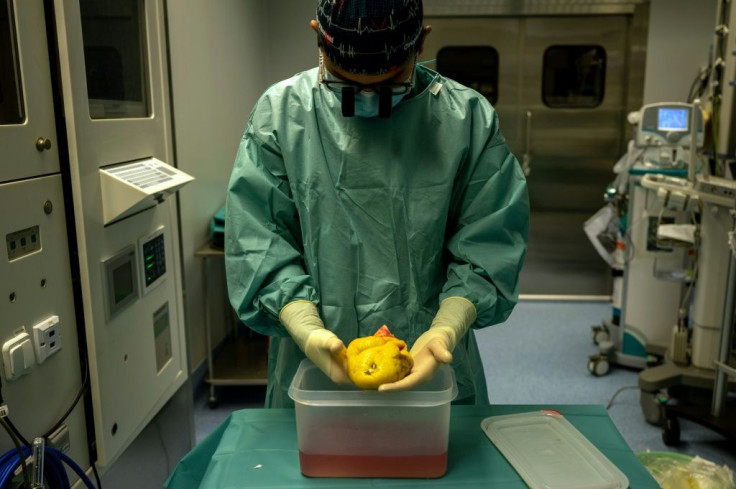 Cardiovascular surgeon Juan Esteban de Villarreal prepares to place a donor's heart into a patient in Spain, the world leader in organ transplants