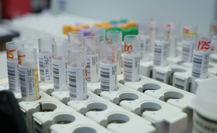 Blood specimen tubes are seen in the laboratory of Bellville Medical Center in the state of Texas where hospitals are overwhelmed due to record Covid-19 hospitalizations