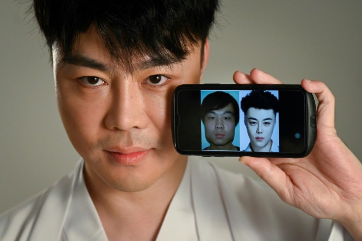 Chinese actor and model Nai Wen has had more than 60 procedures on his face, including laser treatments