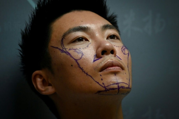 Worried his appearance would detract from opportunities in China's competitive society, Xia Shurong decided to go under the surgeon's knife to reshape his nose -- one of millions of young men in the country turning to cosmetic surgery