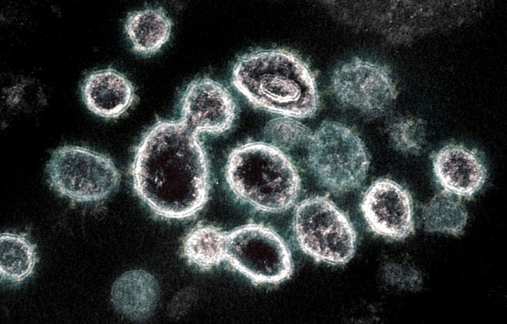 Image non datée d'observations au microscope du SARS-CoV-2, le virus causant le Covid-19, transmise par les Instituts nationaux de santé (NIH) américains