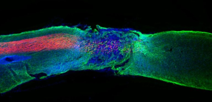 This handout picture obtained from Northwestern University on November 10, 2021 shows a longitudinal spinal cord section treated with the most bioactive therapeutic scaffold; regenerated axons (red) regrew within the lesion