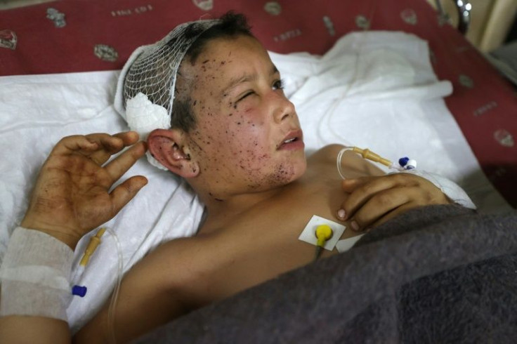 Mahmud Qassum, a Syrian child, was injured in the rebel-held city of Idlib when his family's car was accidentally struck on December 7, 2021 by a US drone targeting an al-Qaeda leader riding nearby on a motorcycle, his family said