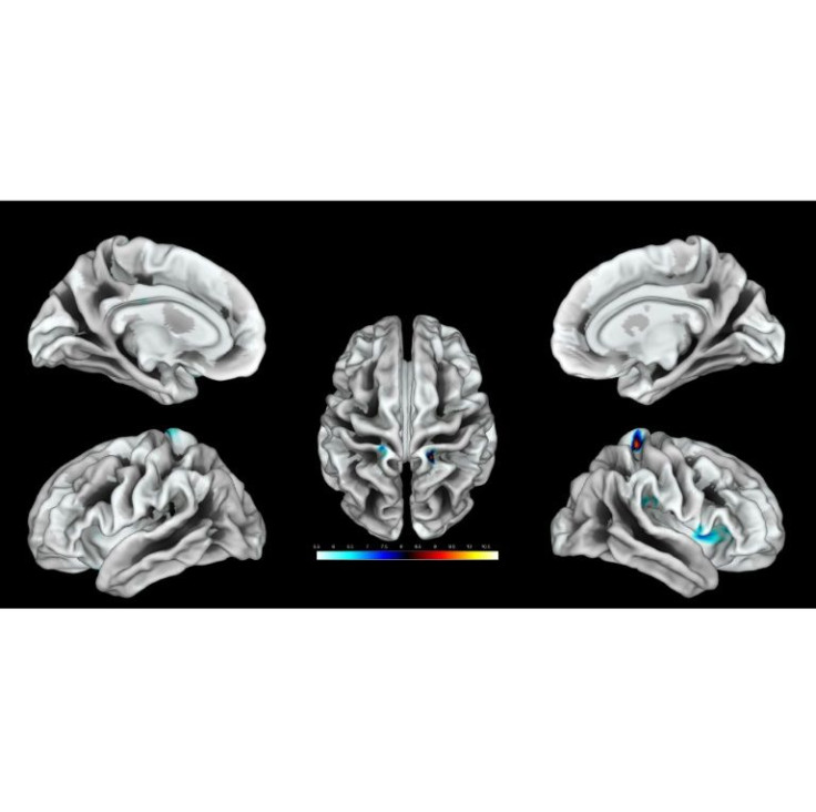 Cortical surface mapping of stimulation of the clitoral region -- a new study has identified the brain region linked to genital touch in women