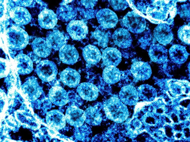 This undated National Institute of Allergy and Infectious Diseases, NIH handout photo obtained August 1, 2021, shows a transmission electron color-enhanced micrograph of SARS-CoV-2 virus particles, isolated from a patient