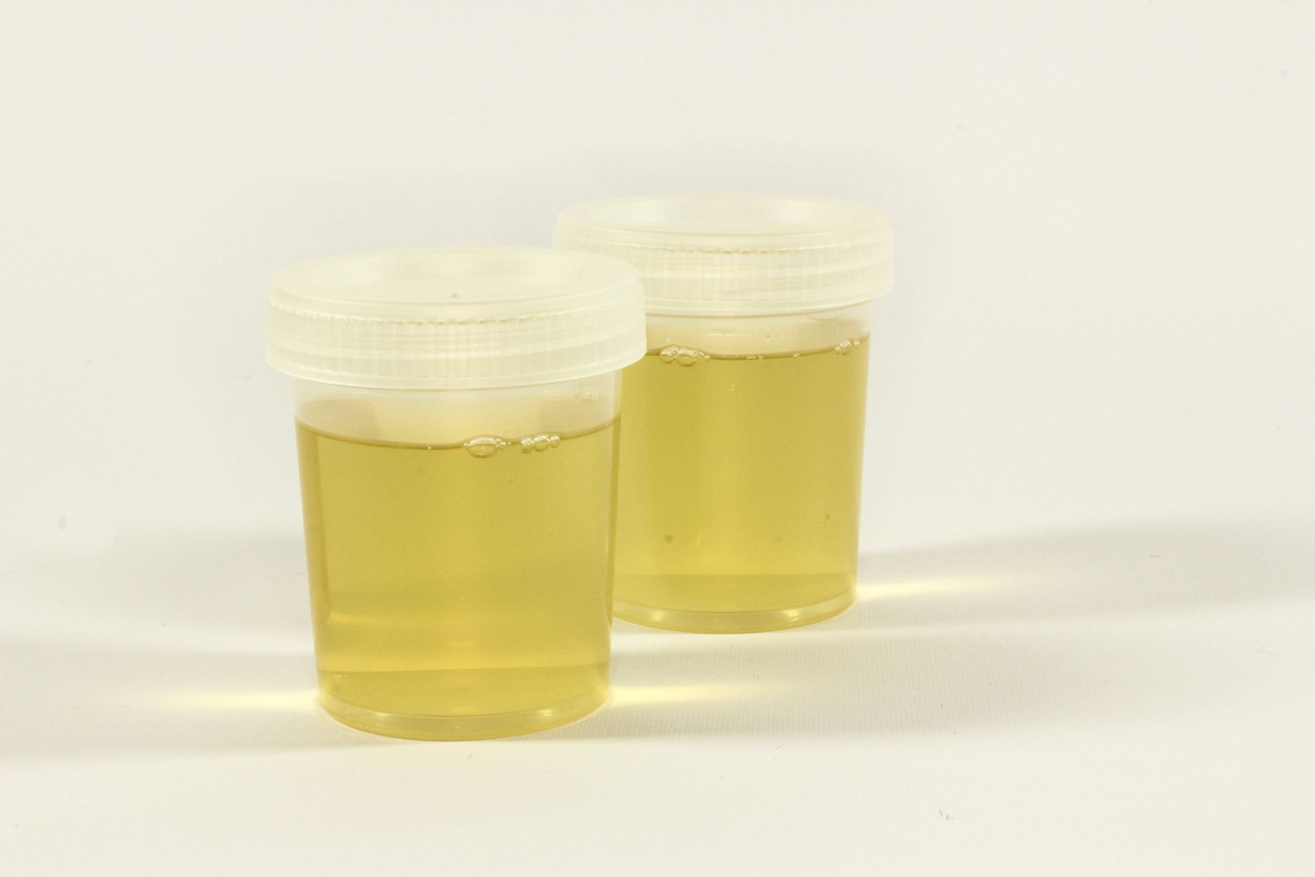 Can You Drink Your Own Urine For Survival? Experts Answer IBTimes