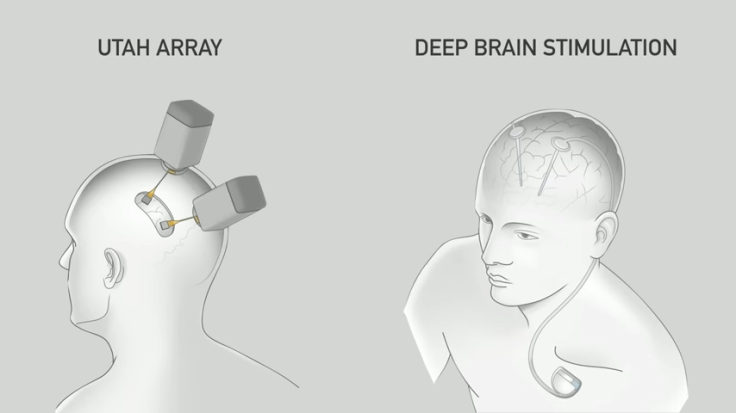 Neuralink Launch Event 