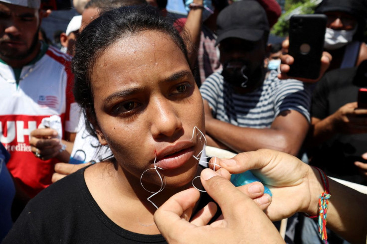 A migrant begins a hunger strike with her mouth sewed shut during a protest to demand free transit through the country outside the office of the National Migration Institute (INM) in Tapachula, Mexico February 15, 2022. 