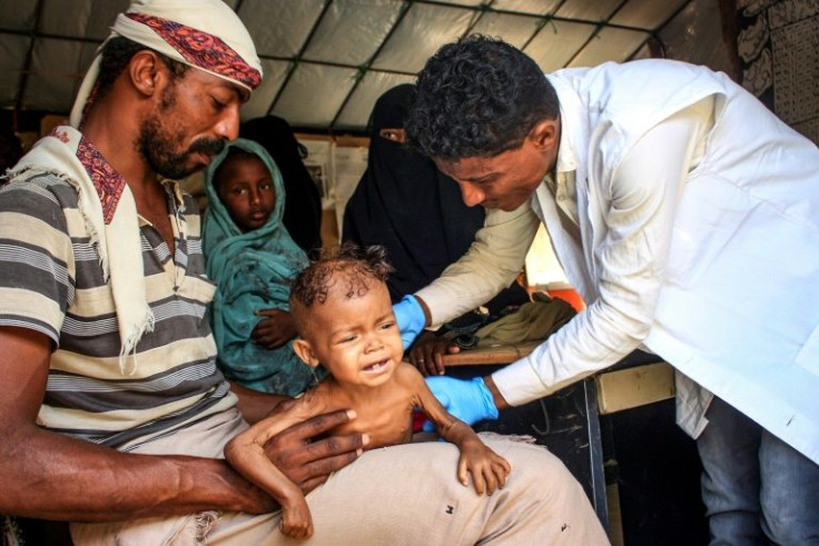 In this photo taken on February 19, 2022, a doctor checks three-year-old Randa Ali, suffering from severe acute malnutrition, in a displacement camp in Yemen's northwestern Hajjah governorate. Aid-starved Yemen is on the verge of total collapse