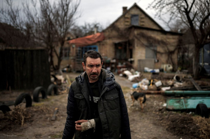 A man, who says Russian soldiers broke his arm, stands outside his house, amid Russia's invasion of Ukraine, in Bucha, in Kyiv region, Ukraine, April 6, 2022. 