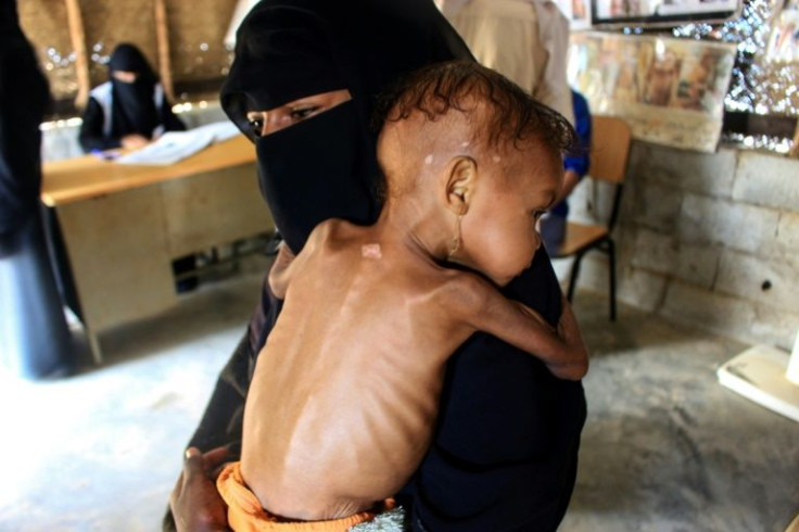 A United Nations-brokered truce that took effect last Saturday has offered a glimmer of hope in the conflict which has triggered what the UN calls the world's worst humanitarian crisis