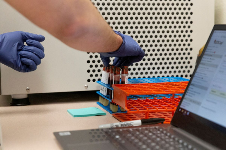 A research assistant at the University of Arizona, prepares blood samples for antibody testing for the coronavirus disease (COVID-19) in Tucson, Arizona, U.S., July 10, 2020. 