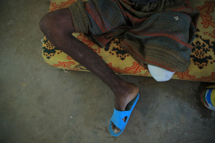 Filimon, 18, a captured fighter from the Tigray People's Liberation Front (TPLF), sits in a guarded hospital room in Dubti Referral Hospital, Afar region, Ethiopia February 24, 2022. Picture taken February 24, 2022. 